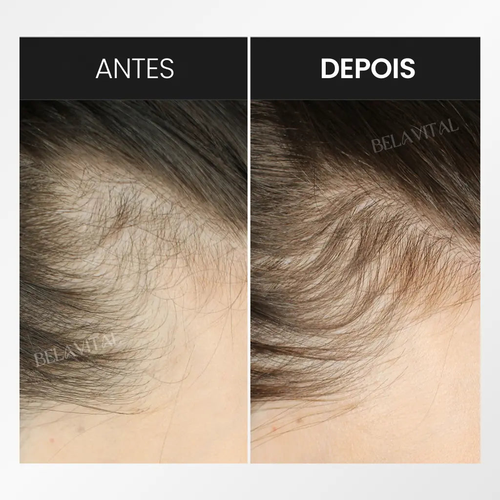 Resultado de uma cliente satisfeita após o uso do kit de crescimento e fortalecimento capilar