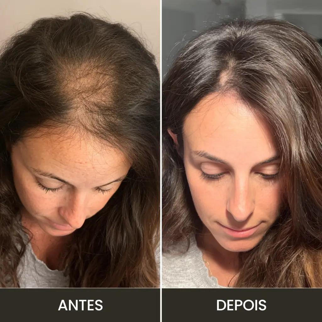 Foto mostrando o "antes" e "depois" enviado por uma cliente após utilizar o kit Derma Capilar da loja Bela Vital