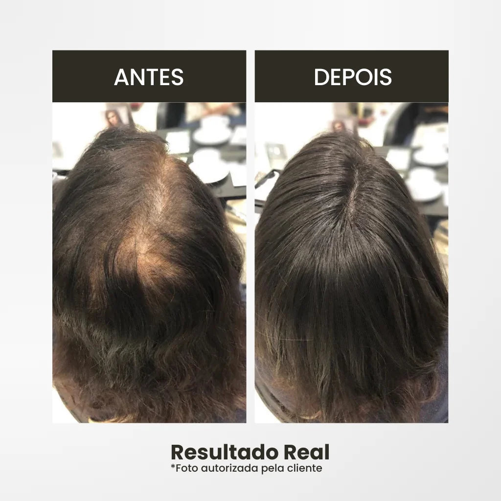 Resultado imediato com o topo de cabelo