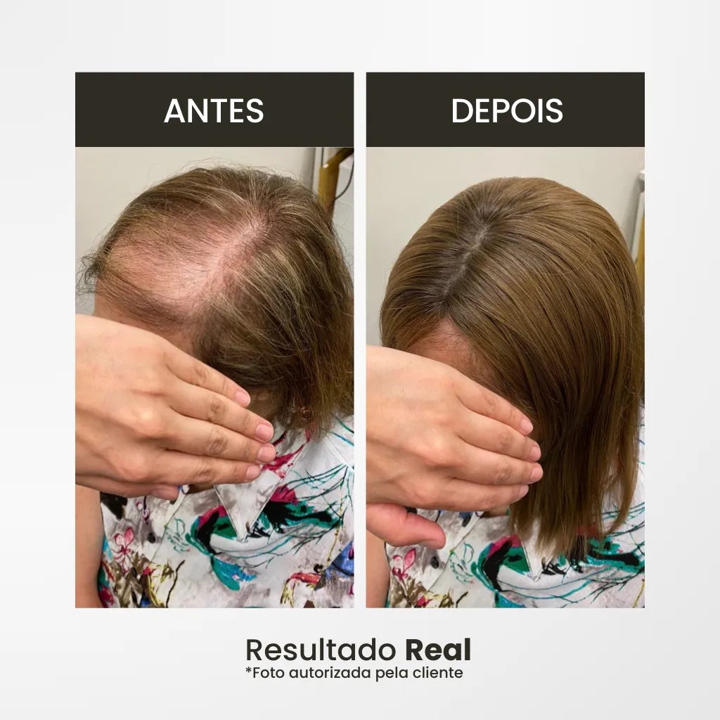 Esconda sua falha capilar com o topo de cabelo da Bela Vital
