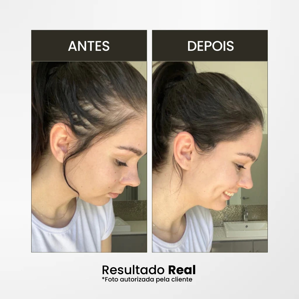 Cubra falhas capilares na hora com o Corretivo capilar 