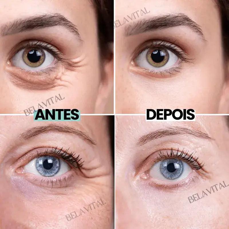 Creme para Área dos Olhos com Arroz: Hidrata e Diminui Olheiras e Rugas - Bela Vital