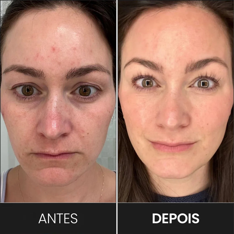 Máscara Vital Skin em uso 1