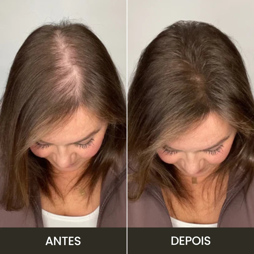Foto mostra o "antes" e "depois" de uma cliente que utilizou o Toppik para esconder sua falha capilar