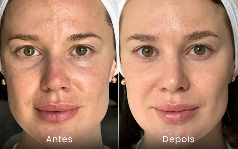 Rejuvenesça sua pele com a luz vermelha