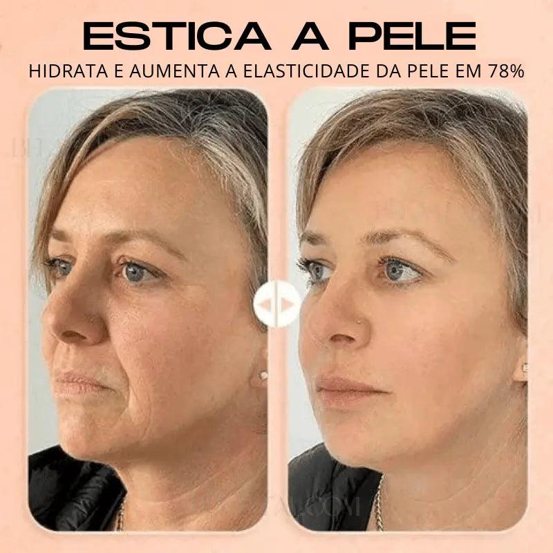 Bastão Hidratante Facial Anti Rugas: Pele Nova e Bem Cuidada - Bela Vital