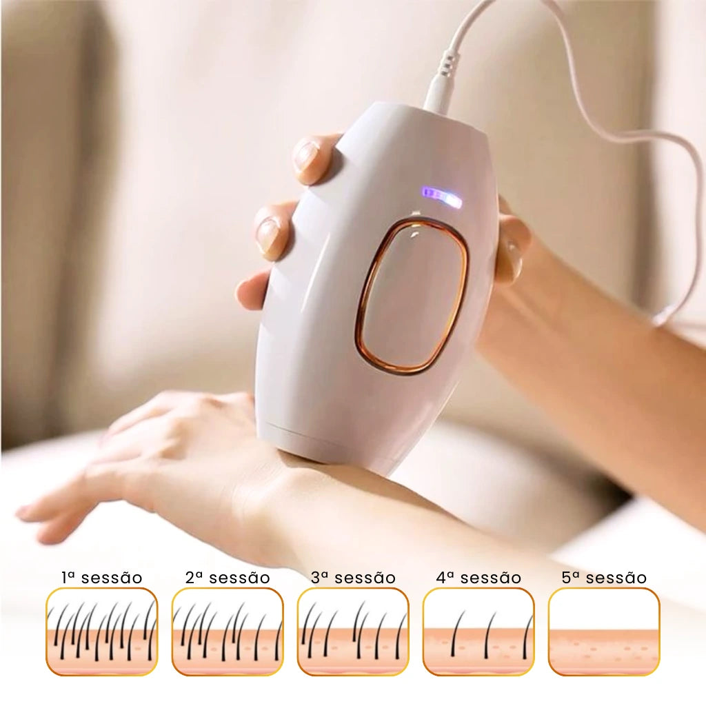 cinco sessões com a depiladora IPL já reduz significativamente a quantidade de pelos