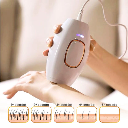 cinco sessões com a depiladora IPL já reduz significativamente a quantidade de pelos
