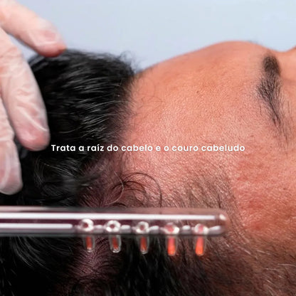 O eletrodo pente da alta frequência trata a raíz do cabelo e o couro cabeludo
