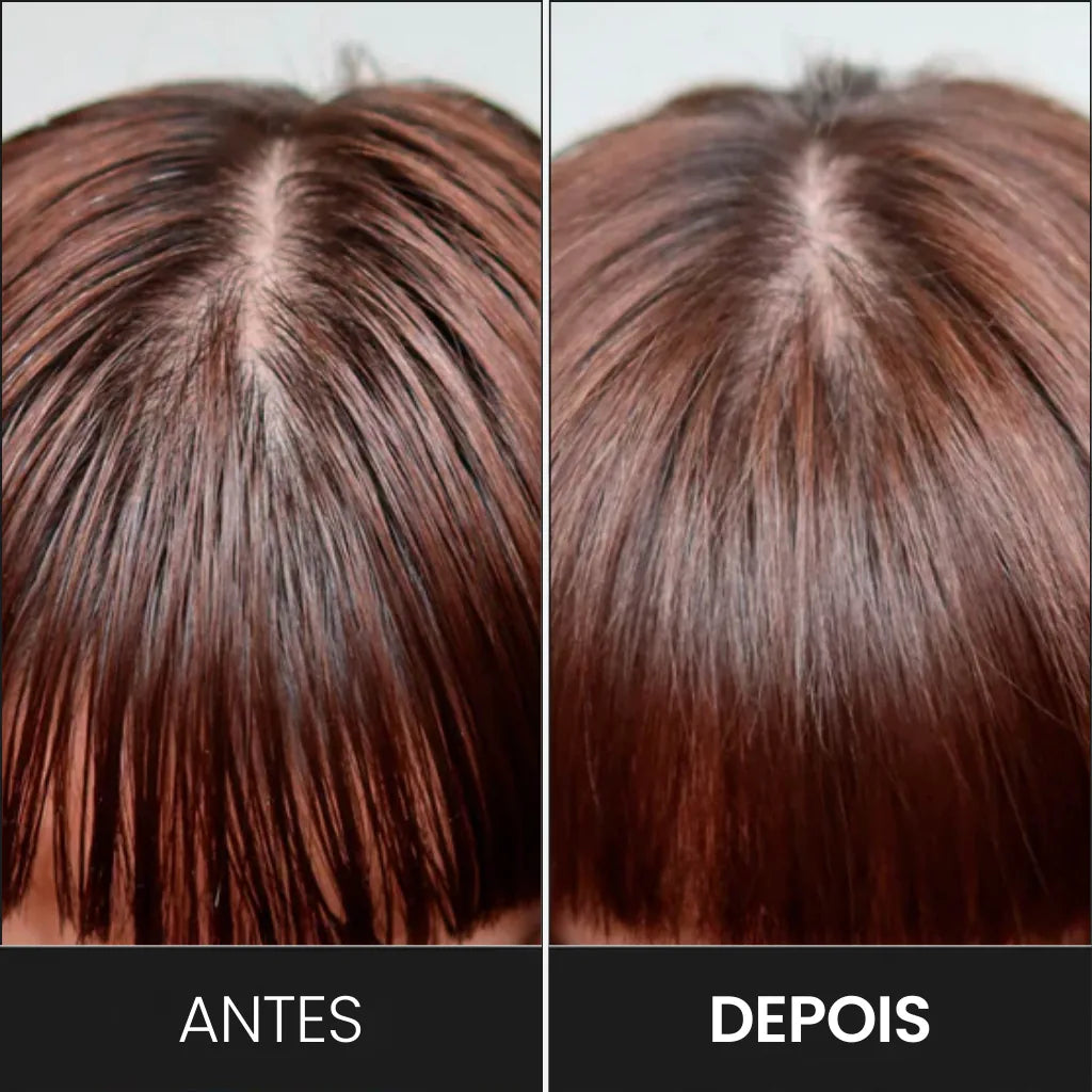 Escova Massageadora Capilar: Conforto e Crescimento