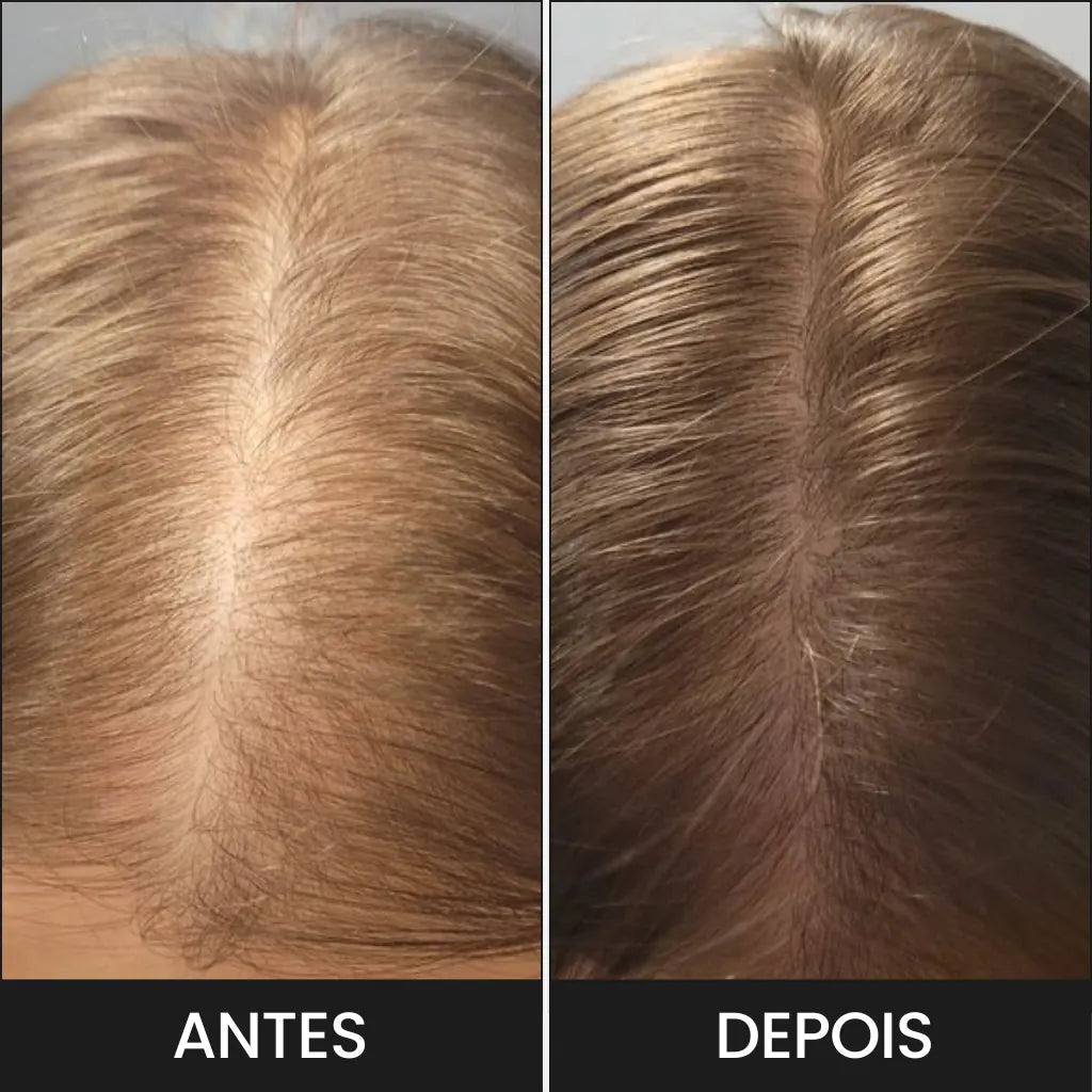 O Spray Hair Helper garante resultados para o aumento do crescimento capilar