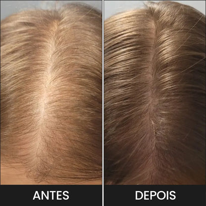 O Spray Hair Helper garante resultados para o aumento do crescimento capilar