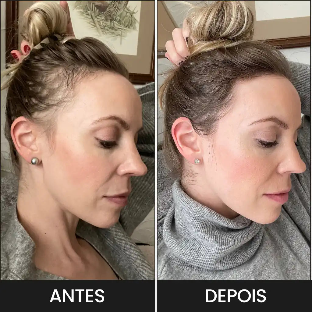 Imagem mostra a eficacia do Spray Hair Helper para tratar as falhas capilares