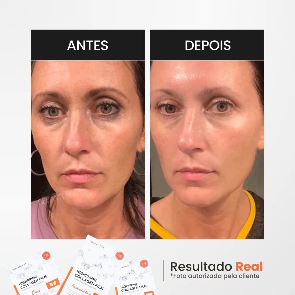 Imagem mostrando os resultados na pele após o uso máscara de colágeno GoldBotox