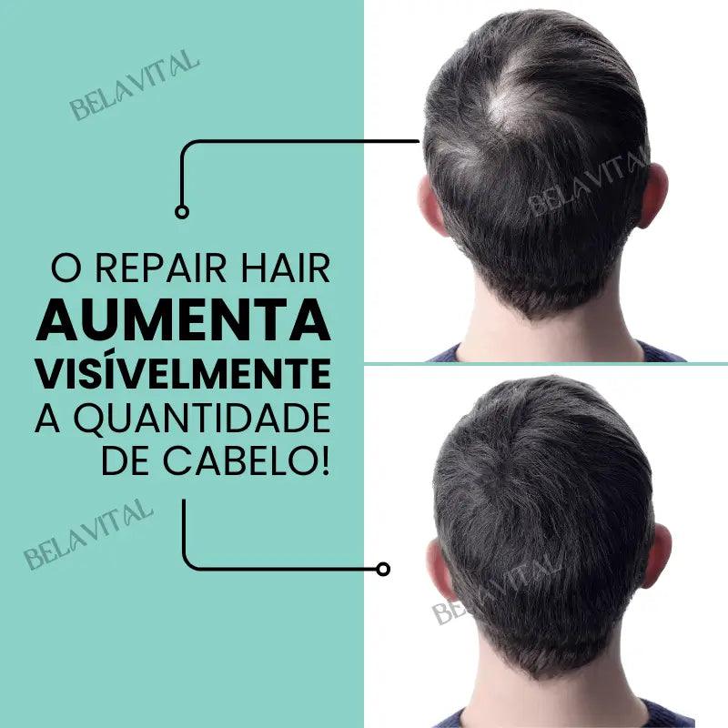 Kit Repair Hair Pro+ com Brinde Exclusivo: O Tratamento Mais Completo Contra Queda de Cabelo e a Calvície! - Bela Vital