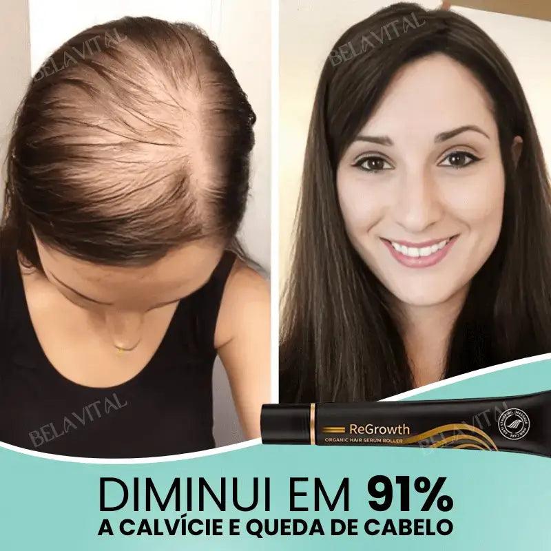 Kit Repair Hair Pro+ com Brinde Exclusivo: O Tratamento Mais Completo Contra Queda de Cabelo e a Calvície! - Bela Vital