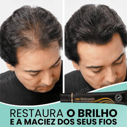 Kit Repair Hair Pro+ com Brinde Exclusivo: O Tratamento Mais Completo Contra Queda de Cabelo e a Calvície! - Bela Vital