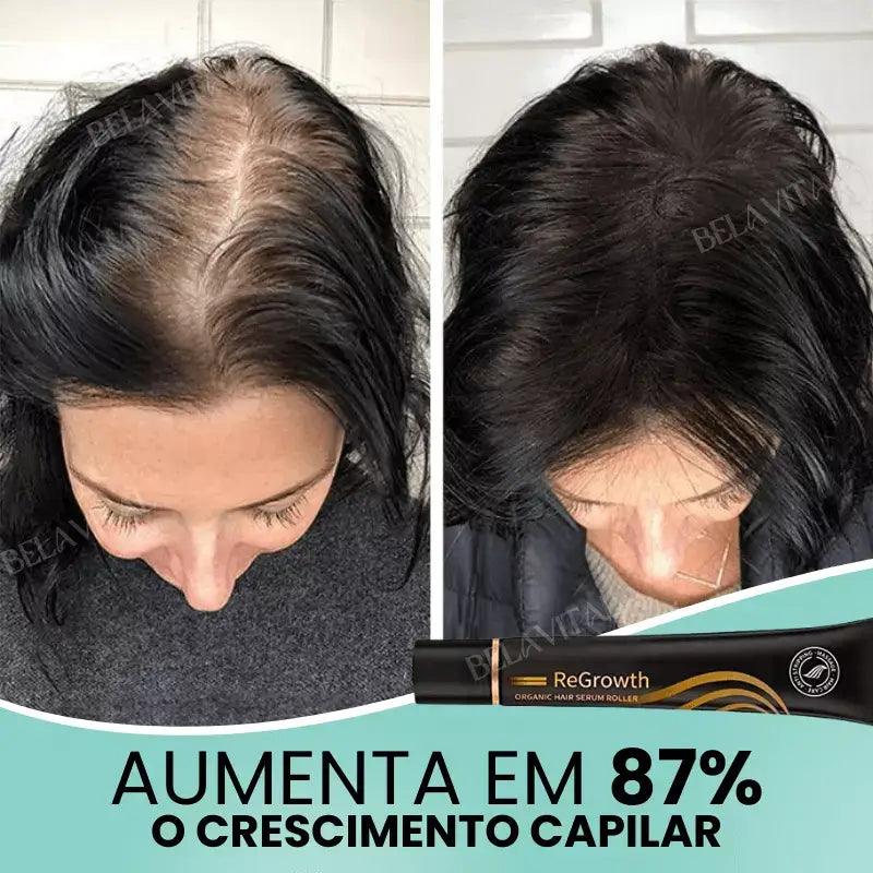 Kit Repair Hair Pro+ com Brinde Exclusivo: O Tratamento Mais Completo Contra Queda de Cabelo e a Calvície! - Bela Vital