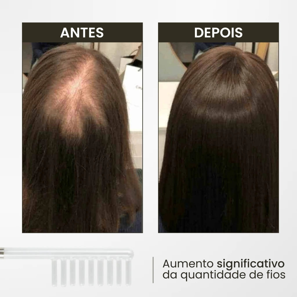 Foto mostrando o "antes" e "depois" enviado por uma cliente após utilizar o kit Derma Capilar da loja Bela Vital