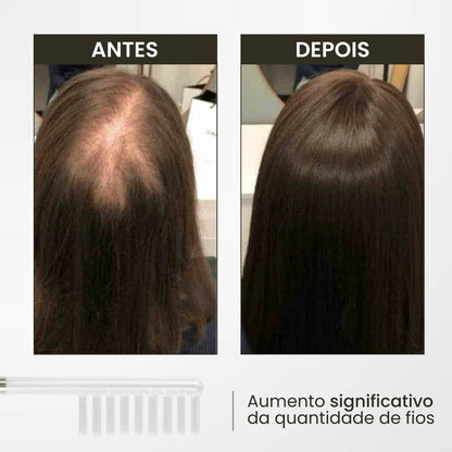 Foto mostrando o "antes" e "depois" enviado por uma cliente após utilizar o kit Derma Capilar da loja Bela Vital