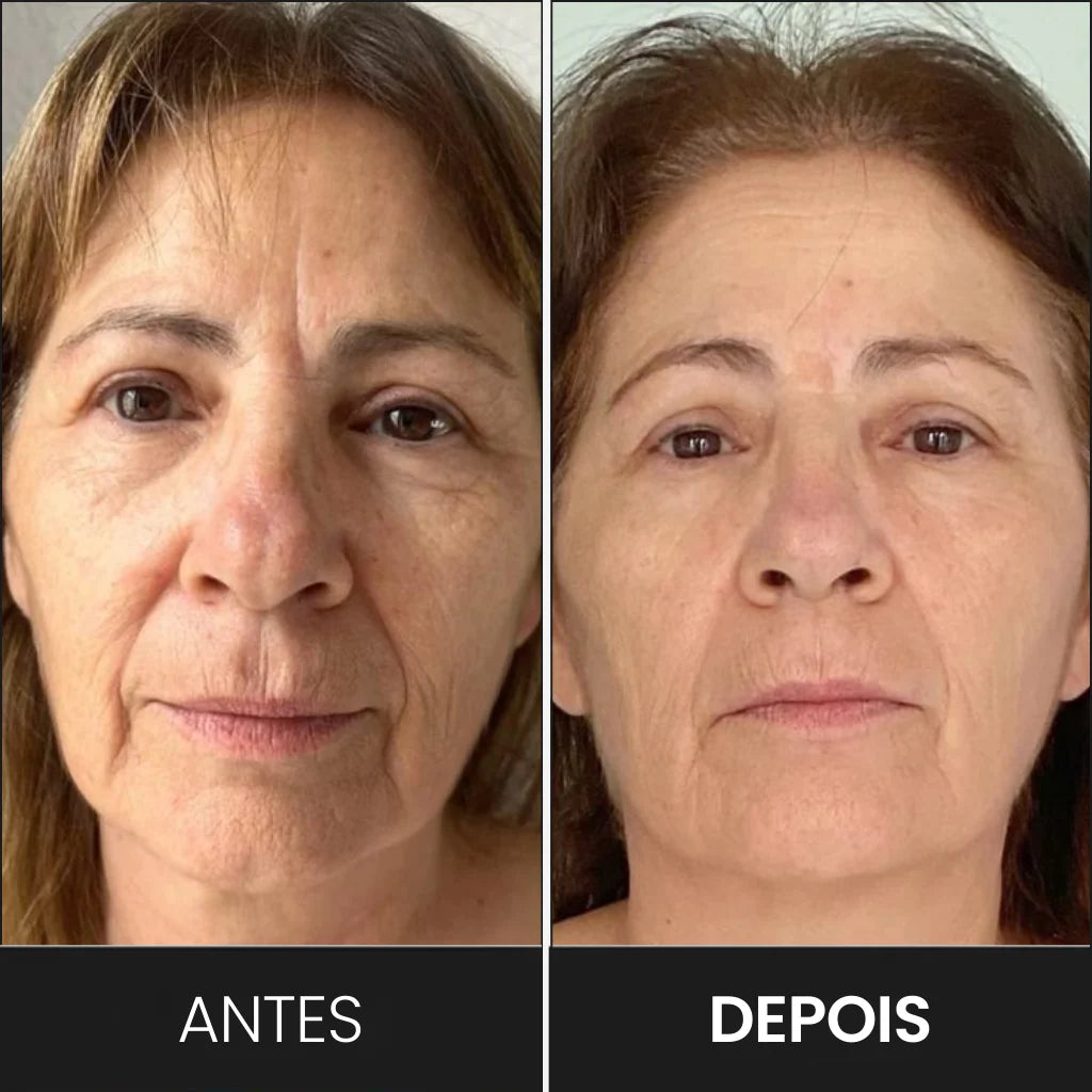 Massageador e Modelador de Rosto LED: Reduz Rugas e Papada