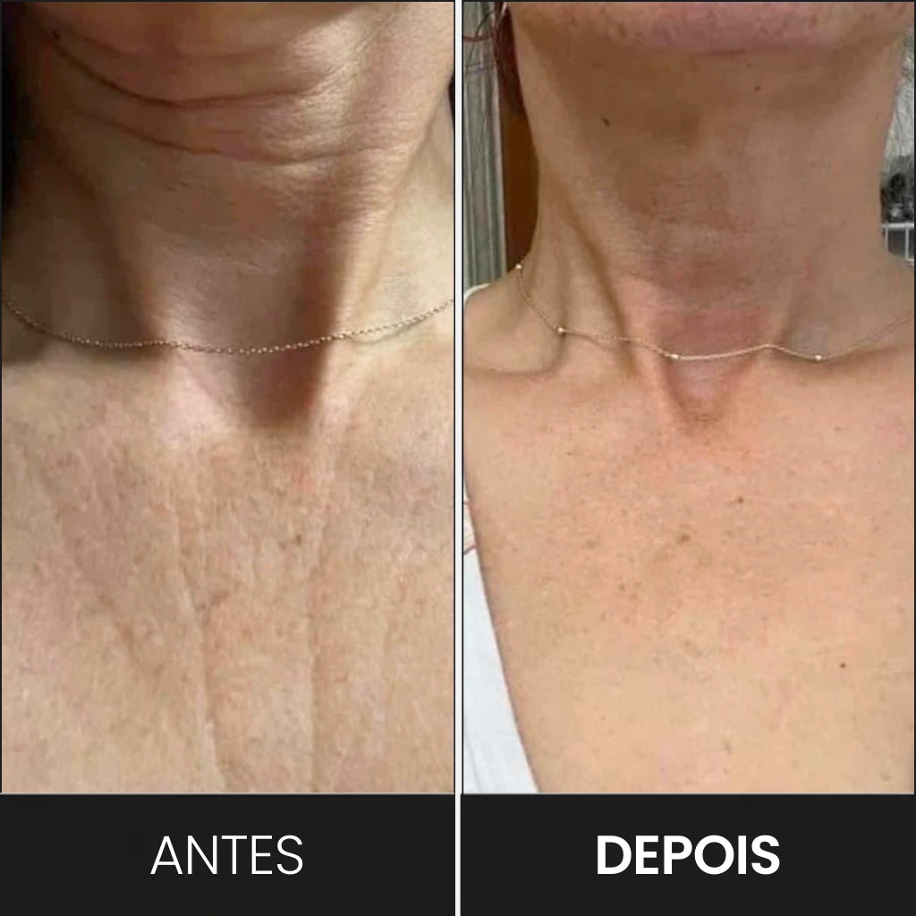 Massageador e Modelador de Rosto LED: Reduz Rugas e Papada