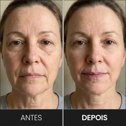 Massageador e Modelador de Rosto LED: Reduz Rugas e Papada