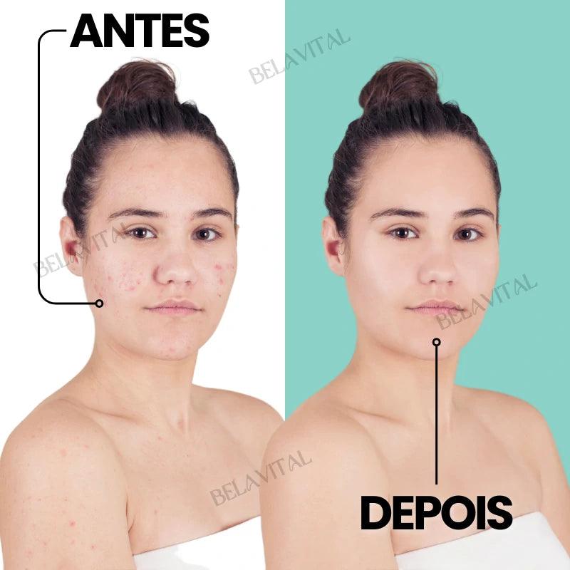 Máscara Facial de Arroz: Hidratação e Brilho Durante o Sono | 20 Unidades - Bela Vital