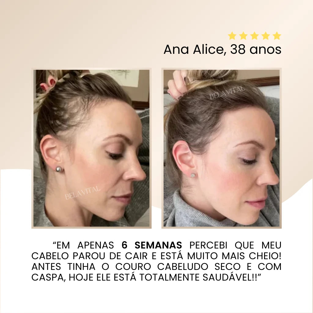 Ana Alice, 38 anos sobre o Massageador Capilar 2 em 1: "Em apenas 6 semanas percebi que meu cabelo parou de cair e está muito mais cheio! Antes tinha o couro cabeludo seco e com caspa, hoje ele está totalmente saudável!"