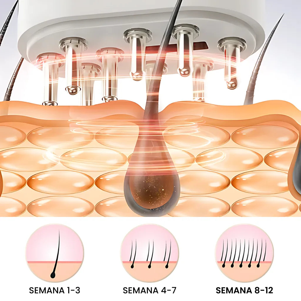 Os resultados são visíveis na utilização contúnua durante 1 a 3 semanas a queda de cabelo para, de 4 a 7 semanas o crescimento volta a ocorrer aos poucos e é normalizado de 8 a 12 semanas.