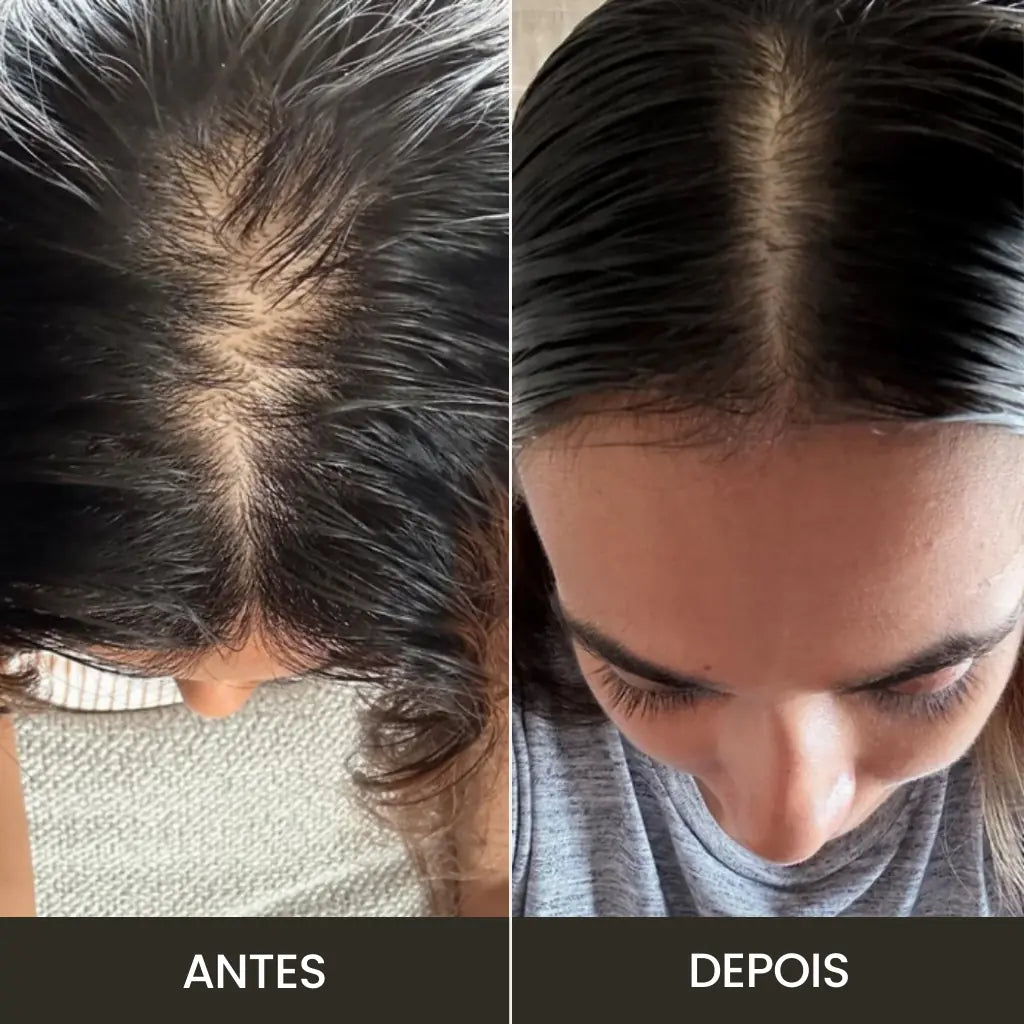cliente satisfeita com o crescimento capilar após o uso do massageador elétrico