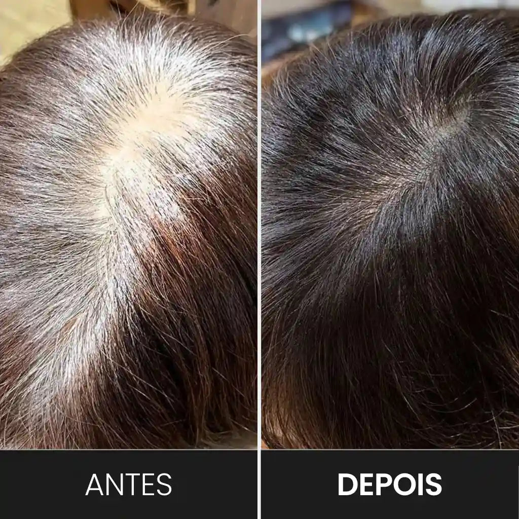 Naturi Color Aumenta sua autoestima em apenas 15 minutos.