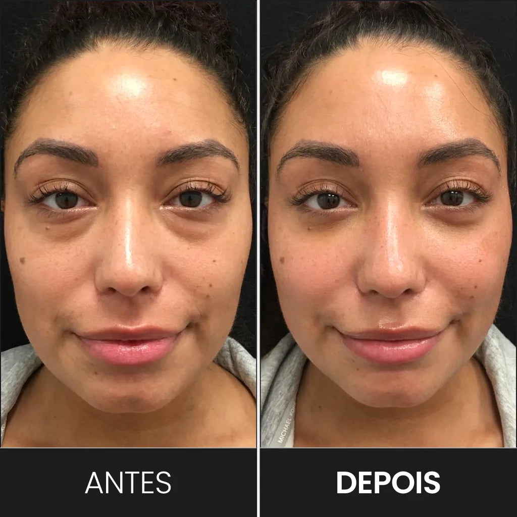 Foto mostrando a comparação entre o antes e o depois do tratamento com os óculos terapêuticos da loja bela vital