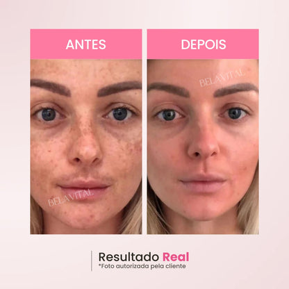 Tenha resultados incríveis utilizando os Pads de Limpeza