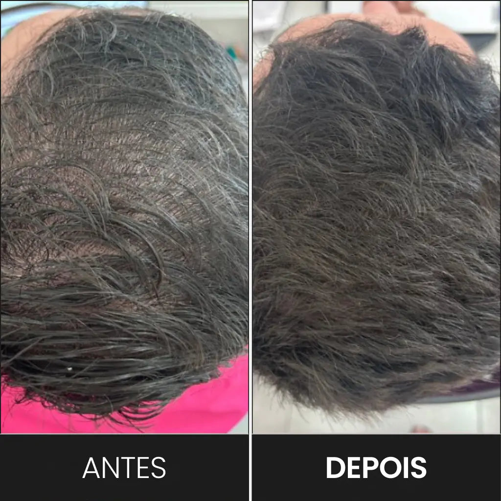 Fotos mostrando como o Shampoo em barras PurcPure Brown escurece naturalmente os fios