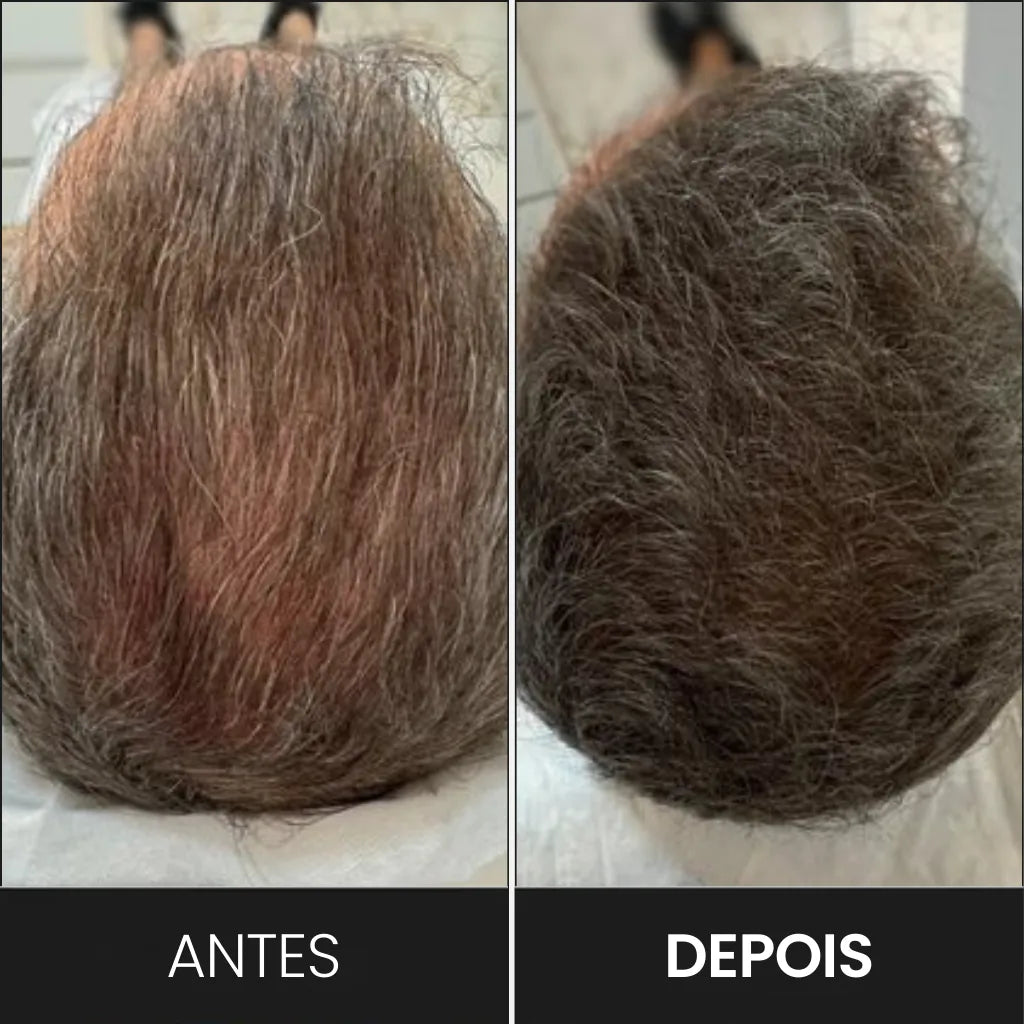 Cliente que usou o shampoo em barra purcpure brown e teve os fios escurecidos naturalmente