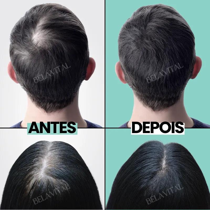 Repair Hair®: 95% Menos Queda 20x Mais Crescimento | Compre 1, Leve 2 - Bela Vital