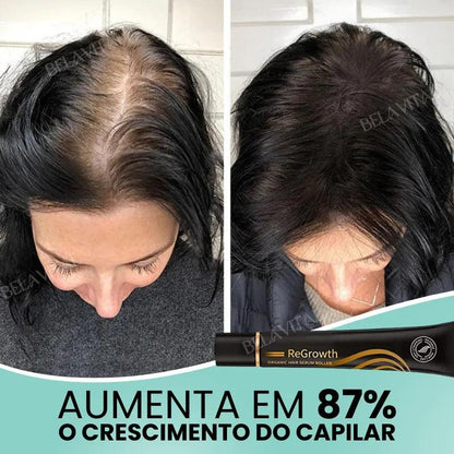 Repair Hair®: 95% Menos Queda 20x Mais Crescimento | Compre 1, Leve 2 - Bela Vital