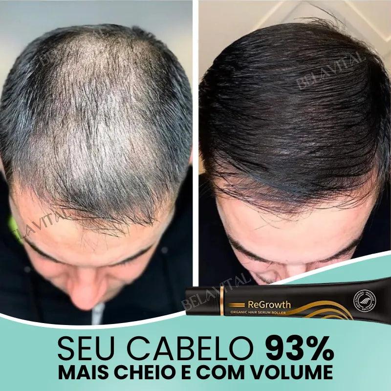 Repair Hair®: 95% Menos Queda 20x Mais Crescimento | Compre 1, Leve 2 - Bela Vital