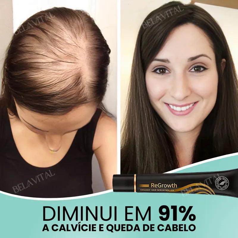 Repair Hair®: 95% Menos Queda 20x Mais Crescimento | Compre 1, Leve 2 - Bela Vital