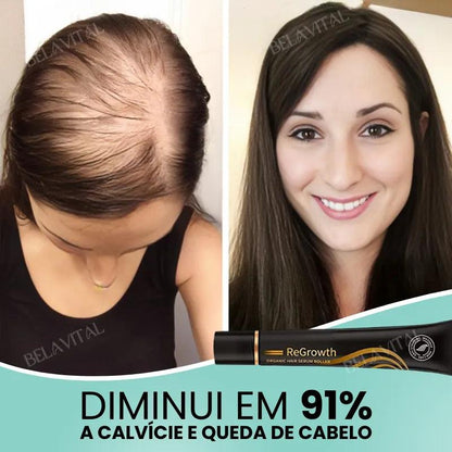 Repair Hair®: 95% Menos Queda 20x Mais Crescimento | Compre 1, Leve 2 - Bela Vital