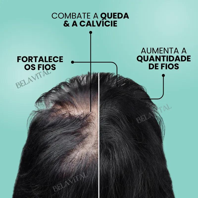 Repair Hair®: 95% Menos Queda 20x Mais Crescimento | Compre 1, Leve 2 - Bela Vital