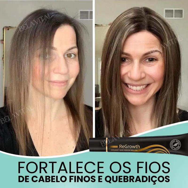 Repair Hair®: 95% Menos Queda 20x Mais Crescimento | Compre 1, Leve 2 - Bela Vital