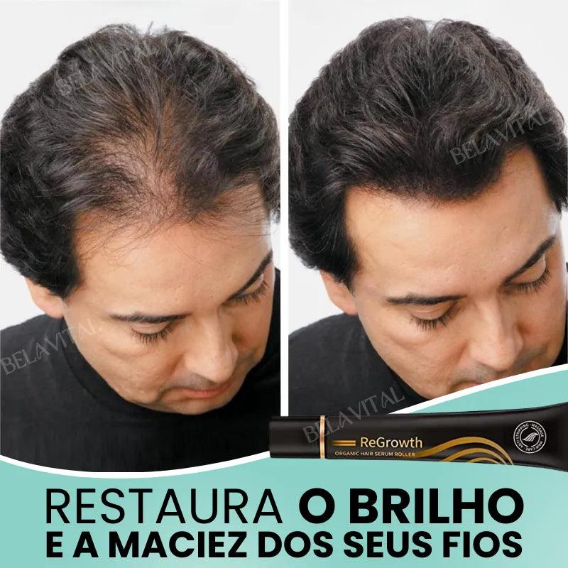 Repair Hair®: 95% Menos Queda 20x Mais Crescimento | Compre 1, Leve 2 - Bela Vital