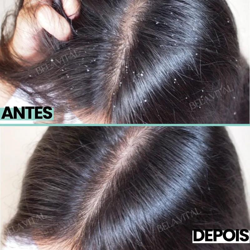 Shampoo Anti Caspa: PurcBlue com Algas Marinhas - Bela Vital