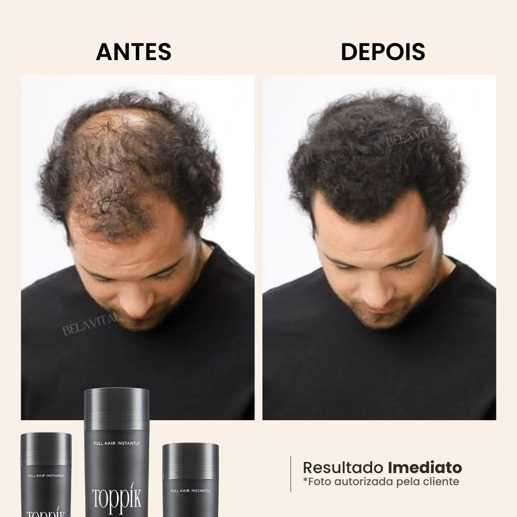 Foto mostra o "antes" e "depois" de um cliente que utilizou o Toppik para esconder sua calvície