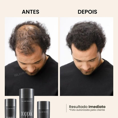 Foto mostra o "antes" e "depois" de um cliente que utilizou o Toppik para esconder sua calvície