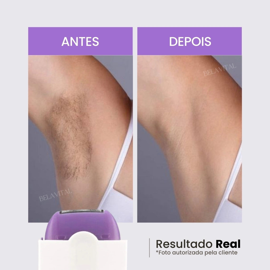 A depiladora laser flex reduz os pelos da axila significativamente!