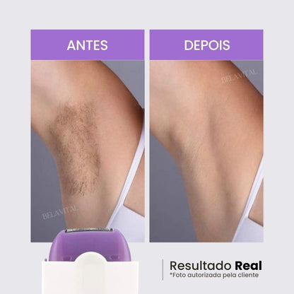 A depiladora laser flex reduz os pelos da axila significativamente!