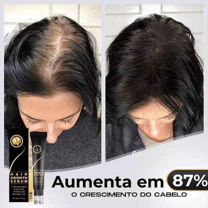 Tônico Capilar Repair Hair® | Crescimento Capilar e Combate à Queda de Cabelo - Bela Vital